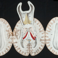 Brain flap anatomy opened to another layer
